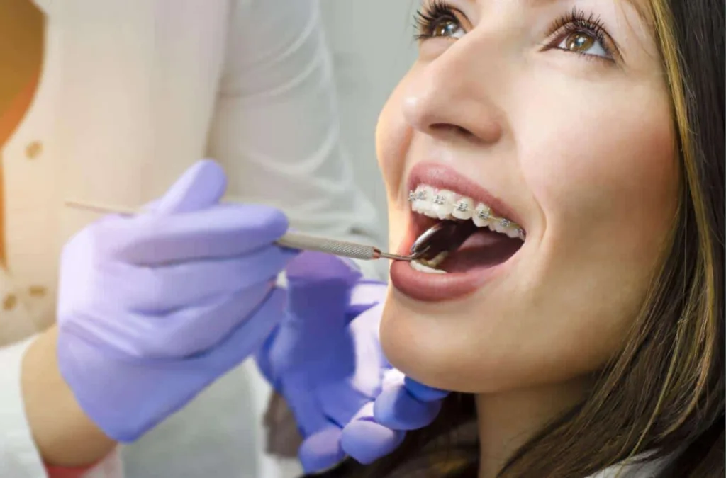 woman asks Can you get your teeth cleaned while wearing braces