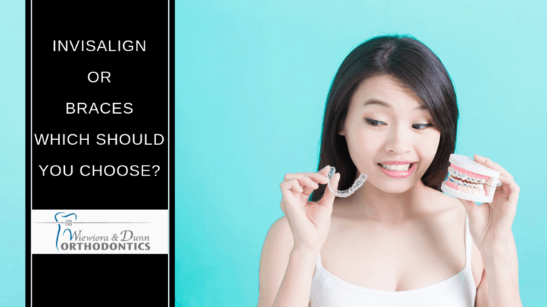 Invisalign or Braces, which to choose