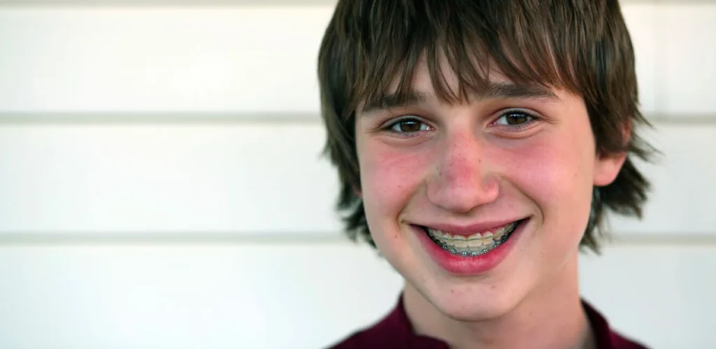 boy before getting your braces off