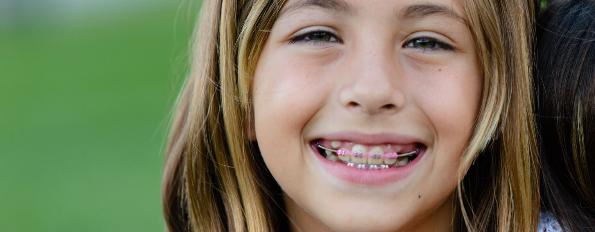 girl smiles after hearing you can get braces with missing teeth